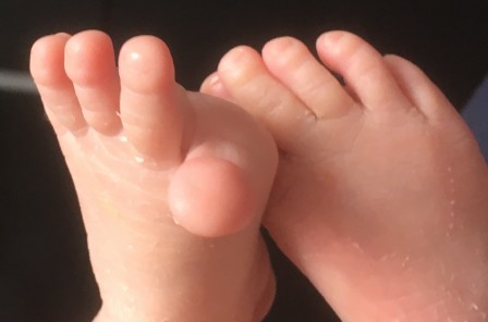 pieds-junior.JPG, janv. 2022